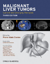 ̈ (3) Malignant Liver Tumors: Current and Emerging Therapies, 3rd edition